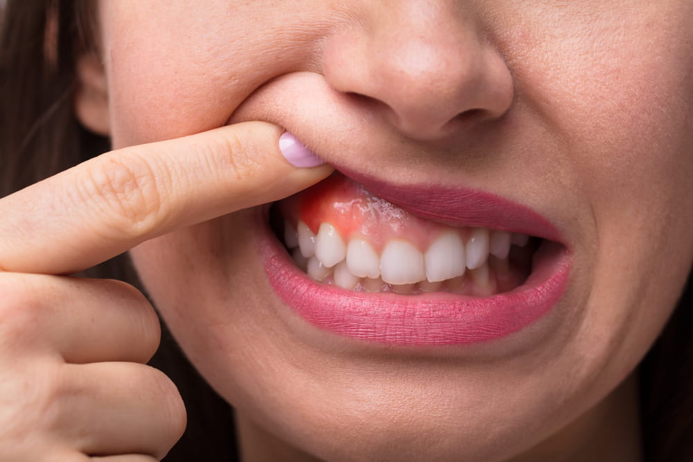 Tips for Maintaining Healthy Gums: Your Key to a Vibrant Smile